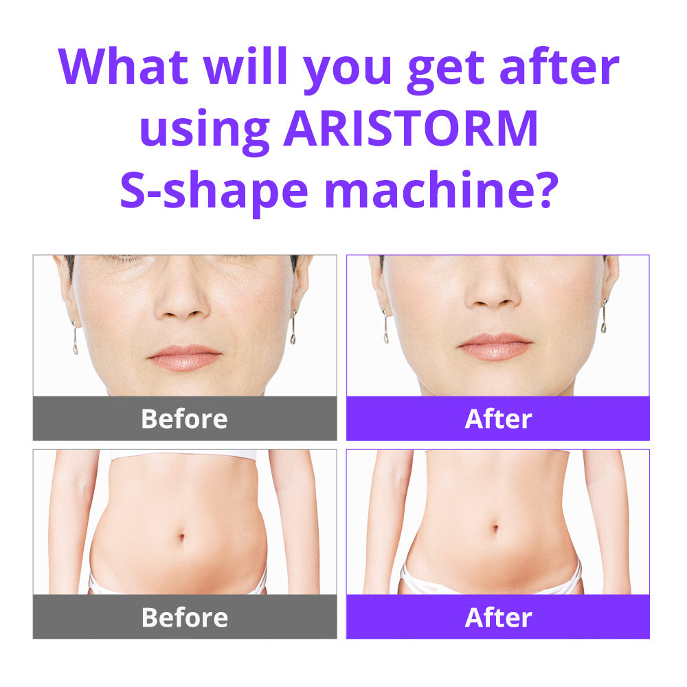 Aristorm S Shape Ultrasound 30K Cavitation 2.5 RF Face Lift Machine Home Use