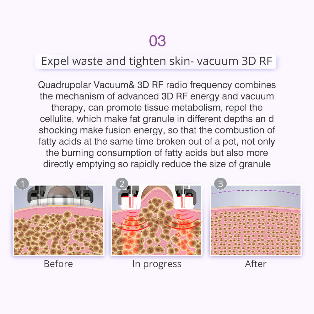 9in1 Ultrasonic Cavitation RF Vacuum Face Tightening Slimming Machine